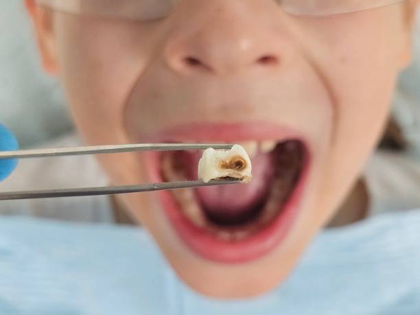 Best Weekend Emergency Dentist in Falls Creek, PA